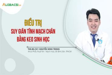 Điều trị suy giãn tĩnh mạch chân bằng keo sinh học