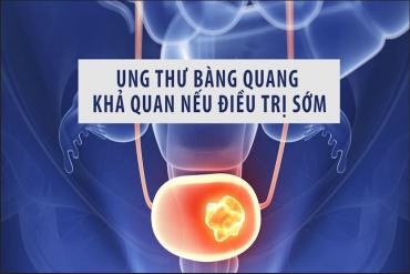 Ung thư bàng quang, khả quan nếu điều trị sớm