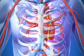 Nội khoa - Tim mạch can thiệp - Can thiệp nội mạch
